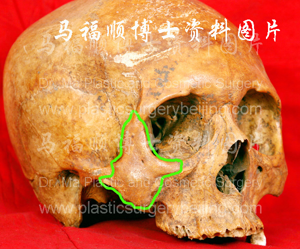 location of the zygomatic bone