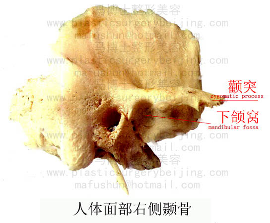 temperal bone