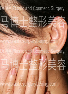 check the thickness of the massetermuscle