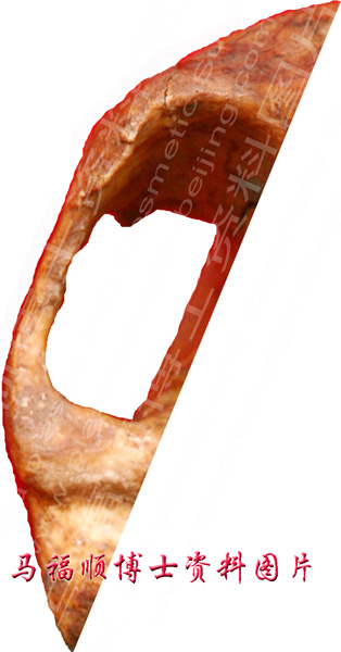 photo of isolated zygomatic arch