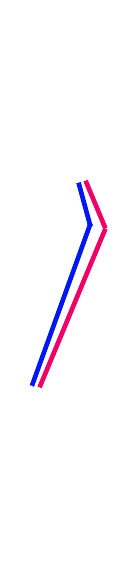 sketch of the zygomatic process point change