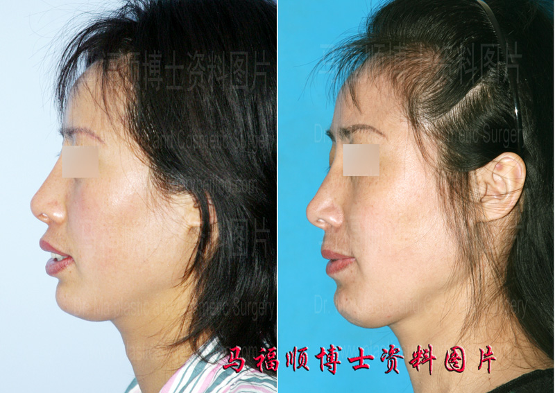 parted lips and sticking out teeth