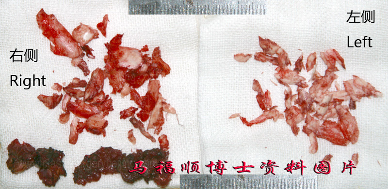 chin and jaw plastic surgery