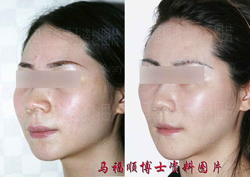 change the big face slimmer in one Or trip