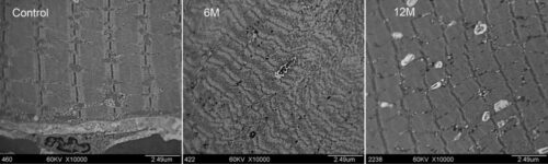 Ultrastructrual Changes in Human Masseter Muscles after Botulinum Neurotoxin A